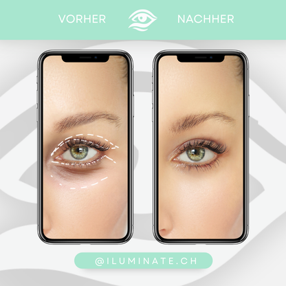 iLuminate – Rotlichttherapie Beauty Brille